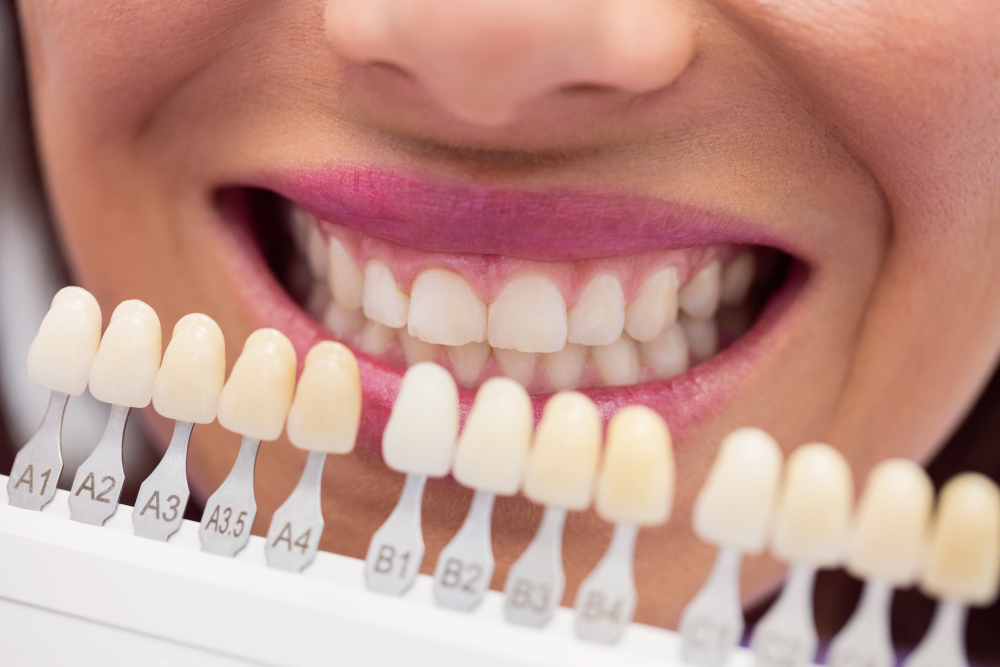 Dental crown after root canal treatment
